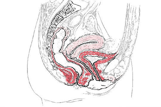 Pelvic organ prolapse illustration